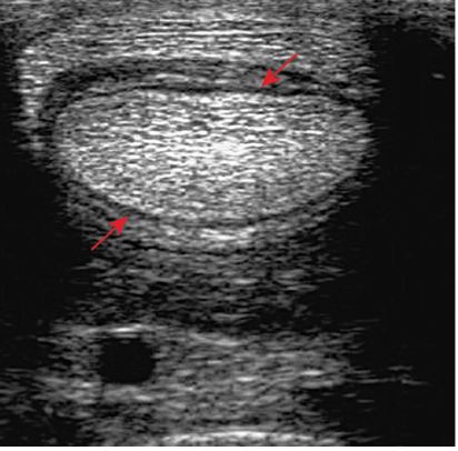 x-ray, horse pastern